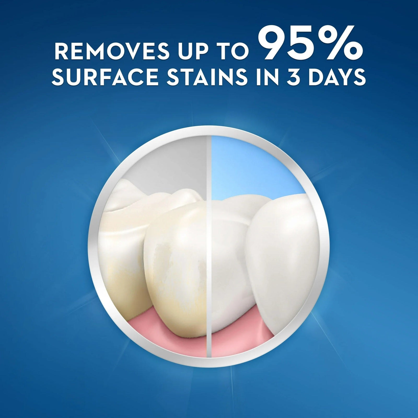 Teeth with a before-and-after effect of using Crest 3D white luxe glamorous toothpaste, indicating stain removal.