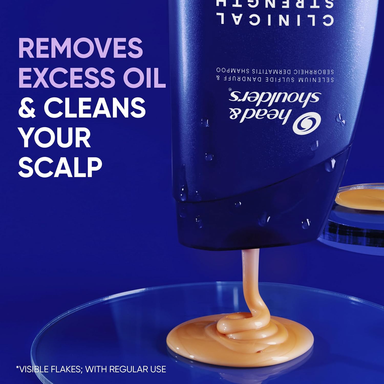 Head and Shoulders clinical strength shampoo removes excess oil and cleans your scalp from visible flakes.