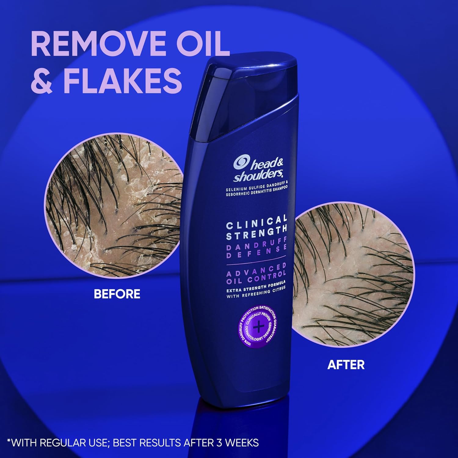 head & shoulders clinical strength shampoo for oily hair removes oil and flakes 